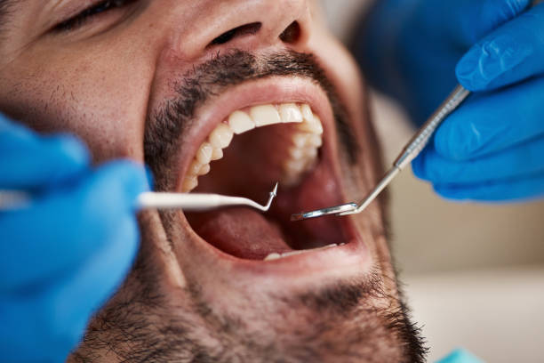 Best Emergency Dentist for Knocked-Out Tooth in South Floral Park, NY
